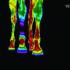 Equine Thermography and Its Role in Horse Health Care